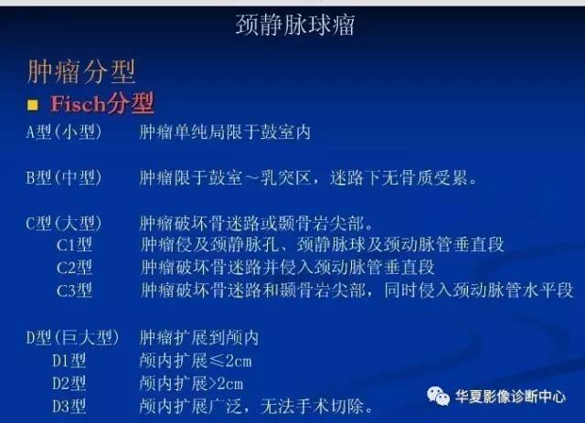 颈静脉球的变异与疾病诊断