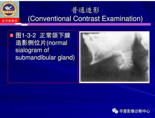 【PPT】涎腺疾病与颞下颌关节疾病影像诊断