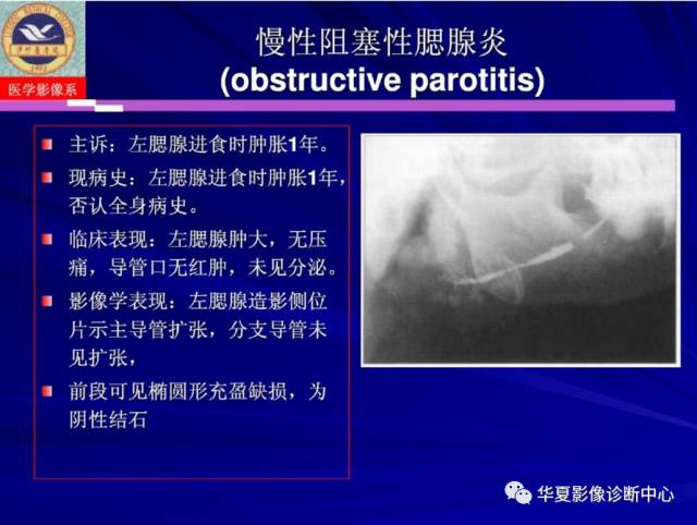 【PPT】涎腺疾病与颞下颌关节疾病影像诊断