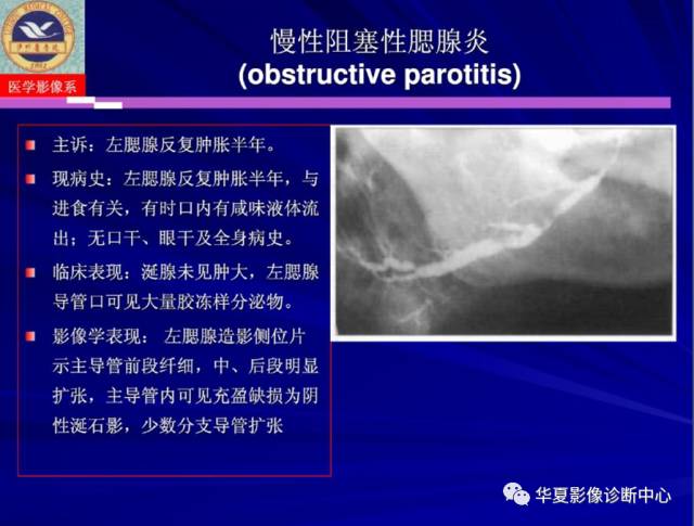 【PPT】涎腺疾病与颞下颌关节疾病影像诊断