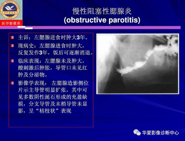 【PPT】涎腺疾病与颞下颌关节疾病影像诊断