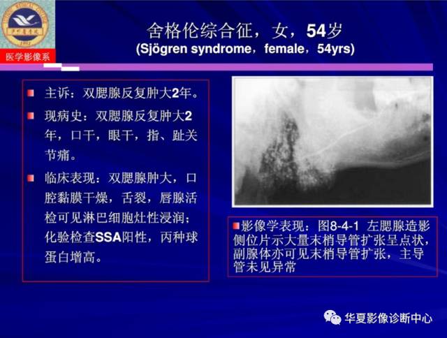 【PPT】涎腺疾病与颞下颌关节疾病影像诊断