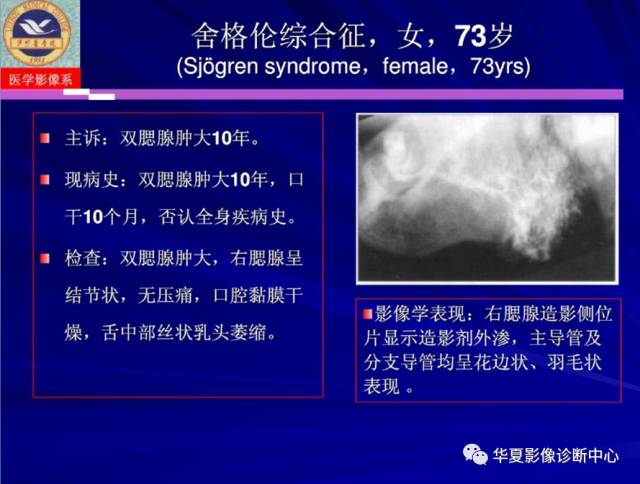 【PPT】涎腺疾病与颞下颌关节疾病影像诊断