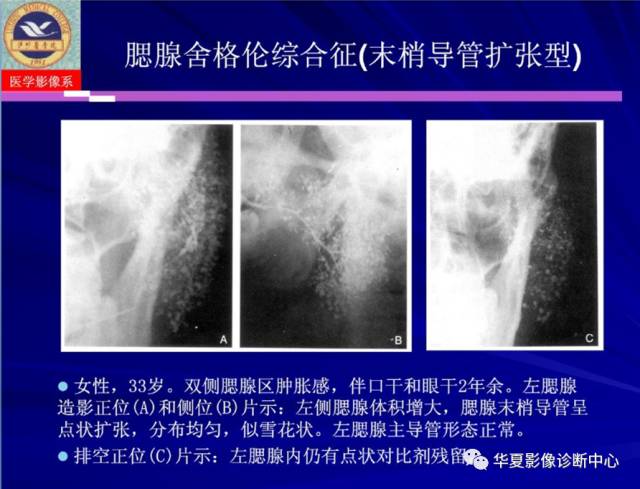 【PPT】涎腺疾病与颞下颌关节疾病影像诊断