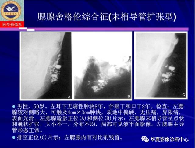 【PPT】涎腺疾病与颞下颌关节疾病影像诊断