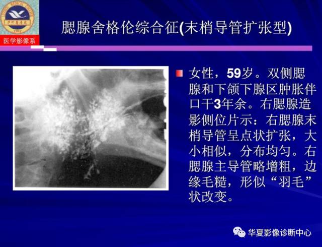 【PPT】涎腺疾病与颞下颌关节疾病影像诊断