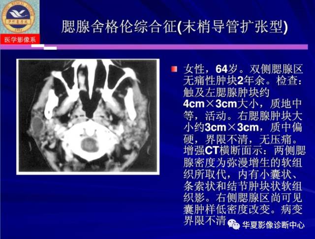 【PPT】涎腺疾病与颞下颌关节疾病影像诊断