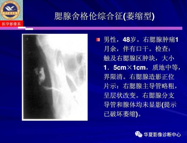 【PPT】涎腺疾病与颞下颌关节疾病影像诊断