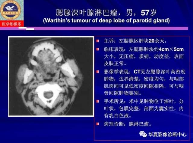 【PPT】涎腺疾病与颞下颌关节疾病影像诊断