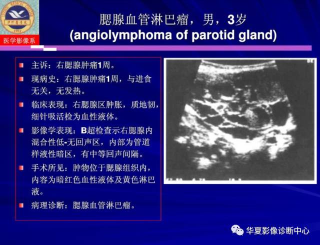 【PPT】涎腺疾病与颞下颌关节疾病影像诊断