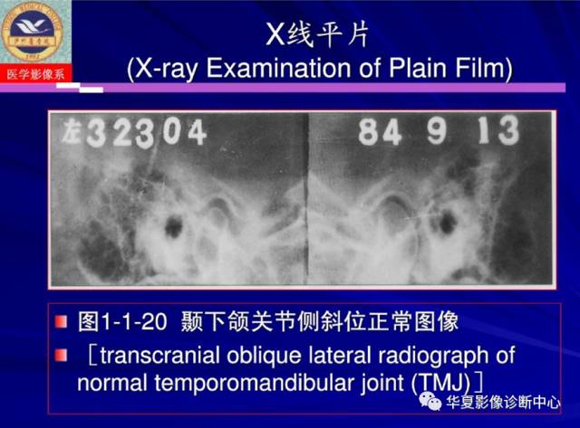 【PPT】涎腺疾病与颞下颌关节疾病影像诊断