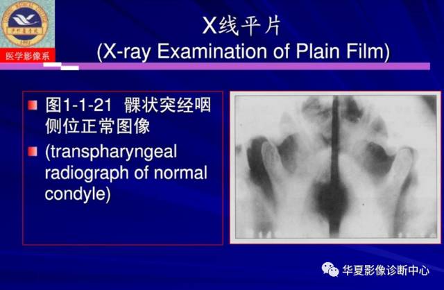 【PPT】涎腺疾病与颞下颌关节疾病影像诊断