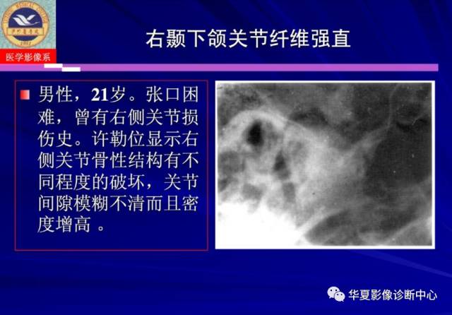 【PPT】涎腺疾病与颞下颌关节疾病影像诊断