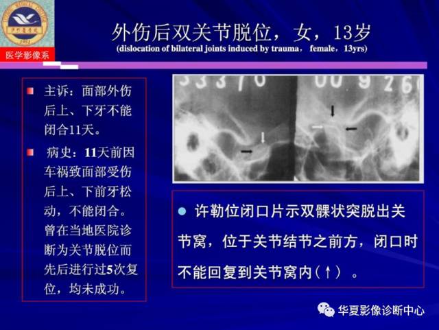 【PPT】涎腺疾病与颞下颌关节疾病影像诊断