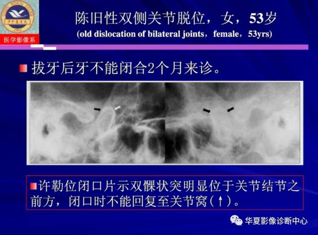 【PPT】涎腺疾病与颞下颌关节疾病影像诊断