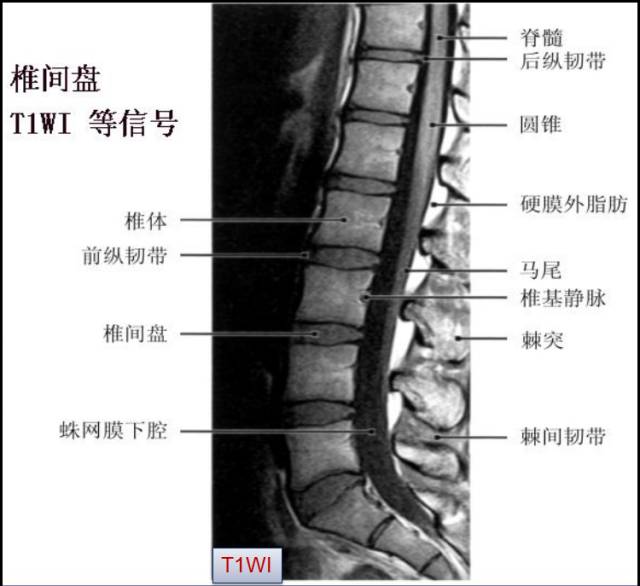 腰椎间盘MRI基本知识 腰椎间盘MRI基本知识