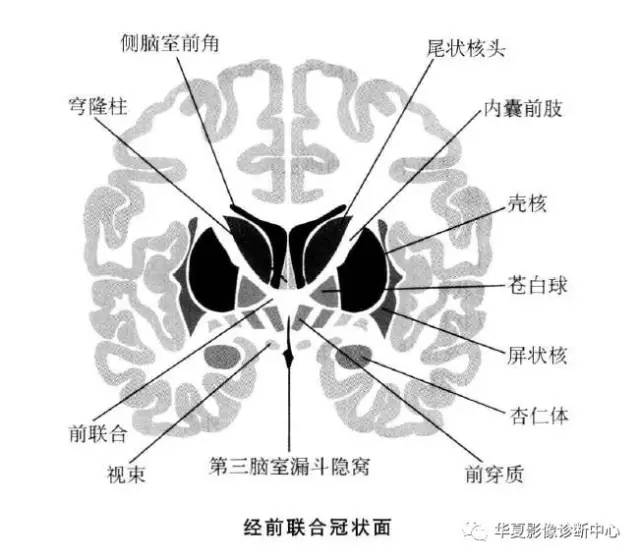 值得收藏的基底节及周围区域解剖详图