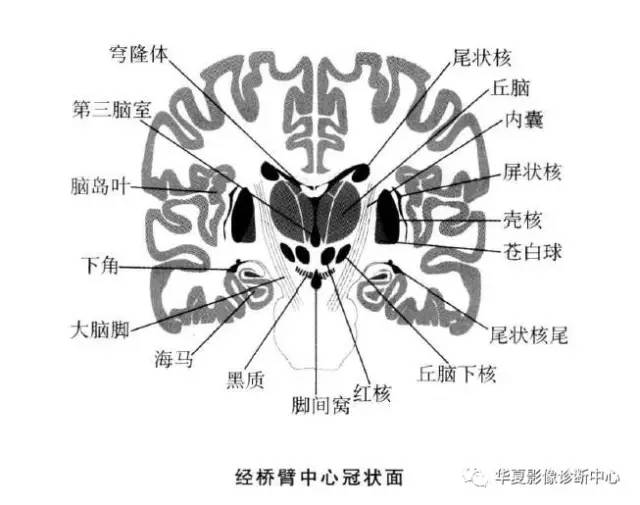 值得收藏的基底节及周围区域解剖详图