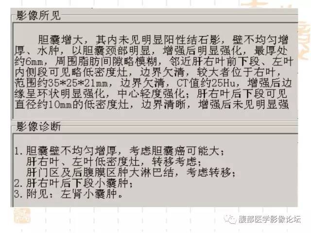 【病例】胆囊炎合并肝脓肿VS胆囊癌合并邻近肝脏直接侵犯鉴别要点 【病例】胆囊炎合并肝脓肿VS胆囊癌合并邻近肝脏直接侵犯鉴别要点