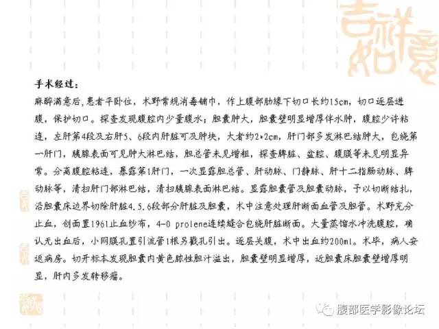 【病例】胆囊炎合并肝脓肿VS胆囊癌合并邻近肝脏直接侵犯鉴别要点 【病例】胆囊炎合并肝脓肿VS胆囊癌合并邻近肝脏直接侵犯鉴别要点