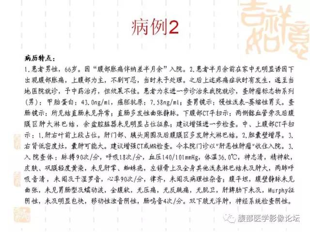 【病例】胆囊炎合并肝脓肿VS胆囊癌合并邻近肝脏直接侵犯鉴别要点 【病例】胆囊炎合并肝脓肿VS胆囊癌合并邻近肝脏直接侵犯鉴别要点