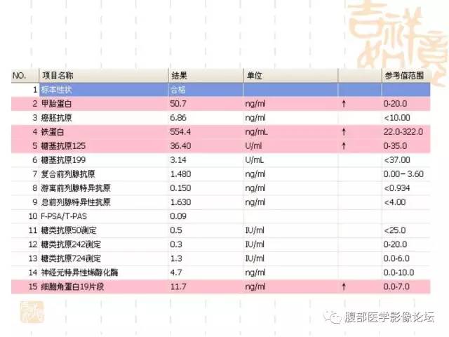 【病例】胆囊炎合并肝脓肿VS胆囊癌合并邻近肝脏直接侵犯鉴别要点 【病例】胆囊炎合并肝脓肿VS胆囊癌合并邻近肝脏直接侵犯鉴别要点