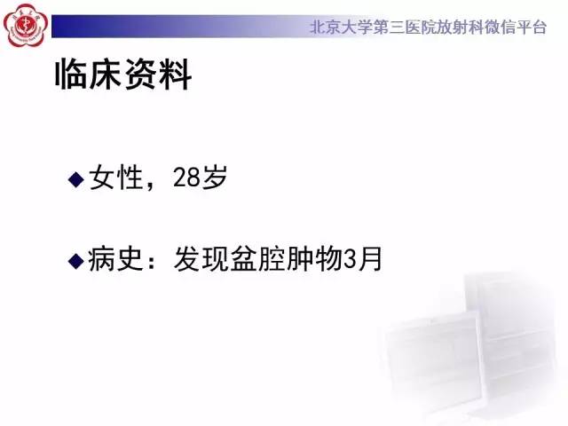 【病例】纤维-卵泡膜细胞瘤1例MR影像表现