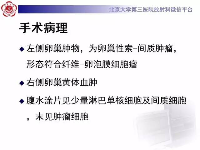 【病例】纤维-卵泡膜细胞瘤1例MR影像表现
