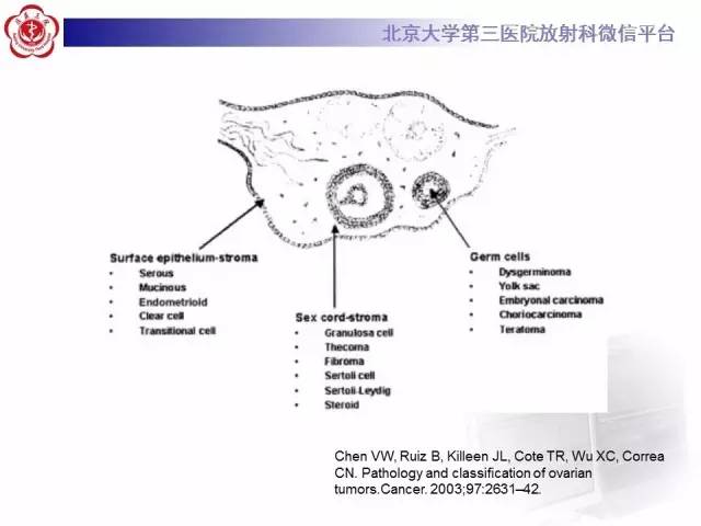 【病例】纤维-卵泡膜细胞瘤1例MR影像表现