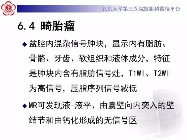 【病例】纤维-卵泡膜细胞瘤1例MR影像表现
