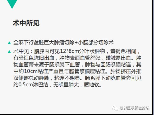 【病例】胃肠道外间质瘤1例CT及MR影像表现 【病例】胃肠道外间质瘤1例CT及MR影像表现