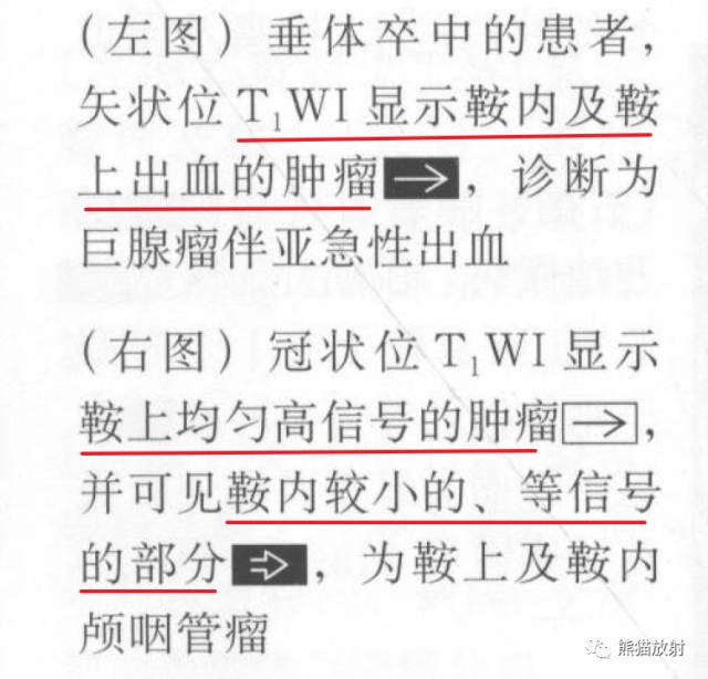 【书摘】鞍上T1WI高信号肿瘤的鉴别诊断