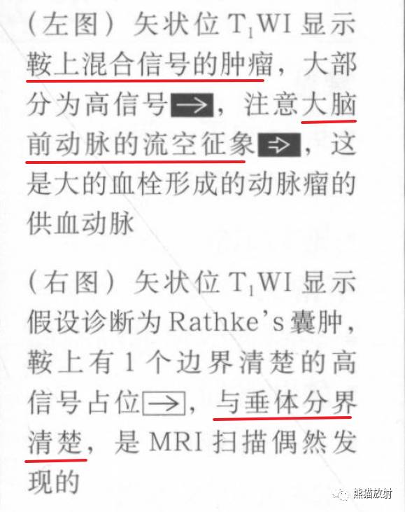 【书摘】鞍上T1WI高信号肿瘤的鉴别诊断