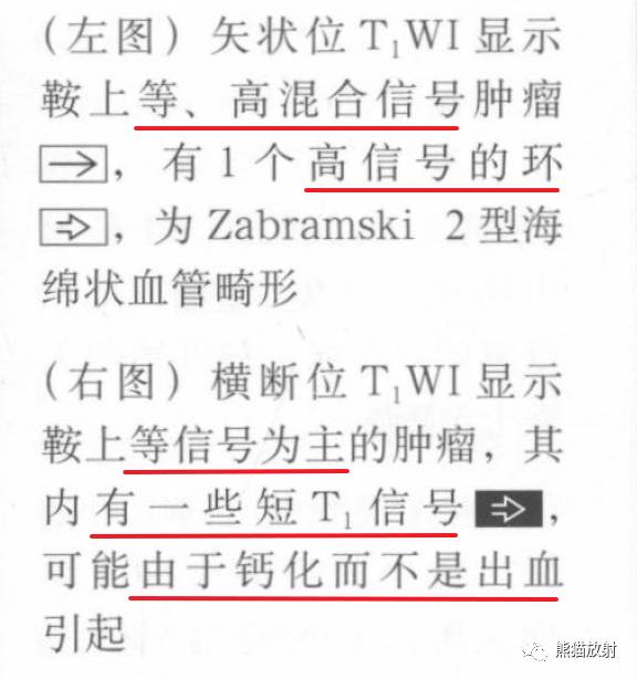 【书摘】鞍上T1WI高信号肿瘤的鉴别诊断