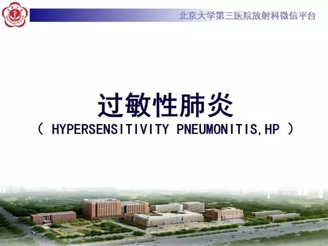 【病例】过敏性肺炎1例CT影像表现