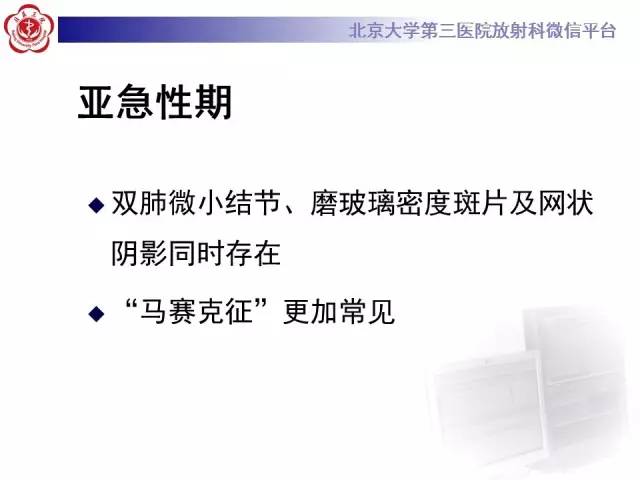 【病例】过敏性肺炎1例CT影像表现