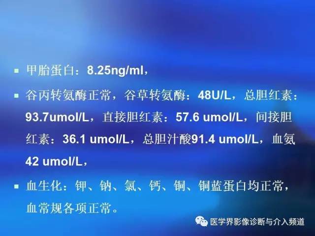 【病例】肝融合性纤维化1例CT及MR影像表现
