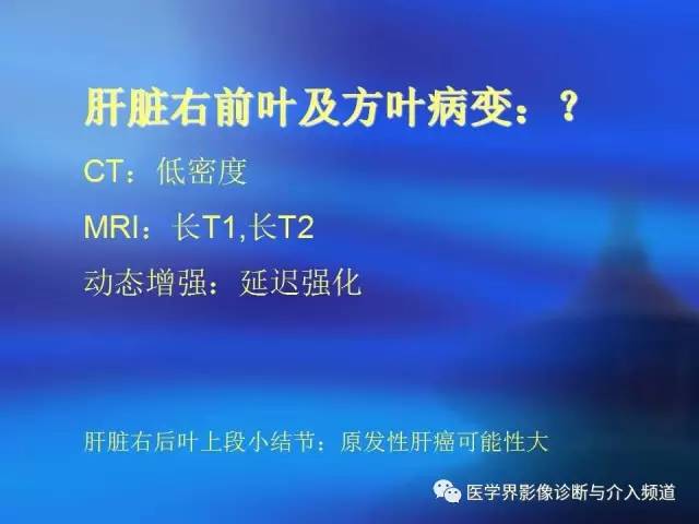 【病例】肝融合性纤维化1例CT及MR影像表现