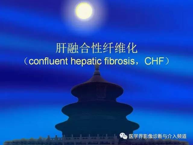【病例】肝融合性纤维化1例CT及MR影像表现