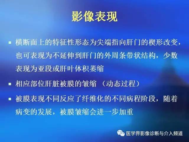 【病例】肝融合性纤维化1例CT及MR影像表现