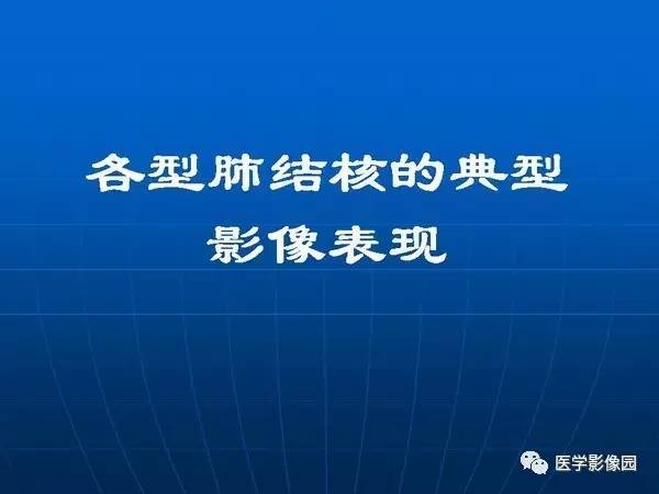 【PPT】各型肺结核的典型影像表现