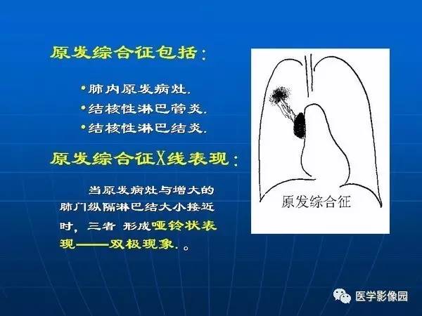 【PPT】各型肺结核的典型影像表现