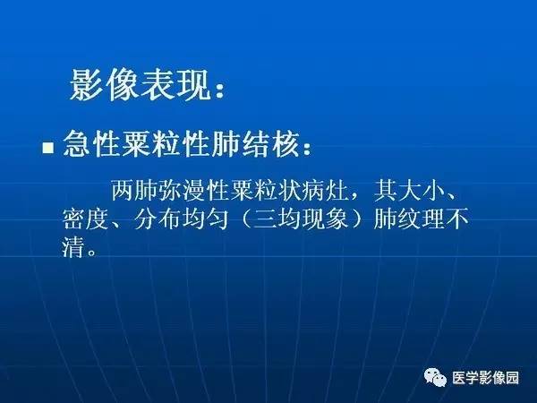 【PPT】各型肺结核的典型影像表现