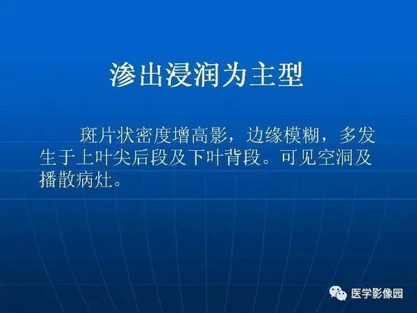 【PPT】各型肺结核的典型影像表现