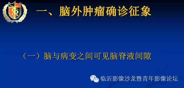【PPT】颅内肿瘤的影像学定位诊断