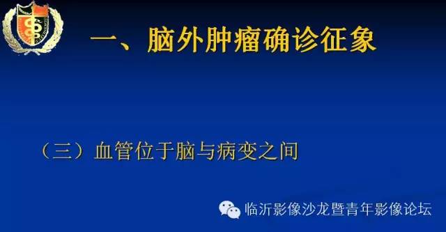 【PPT】颅内肿瘤的影像学定位诊断