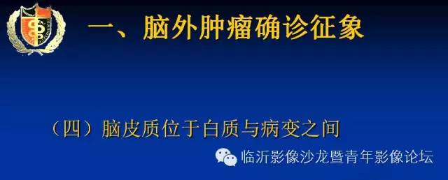 【PPT】颅内肿瘤的影像学定位诊断
