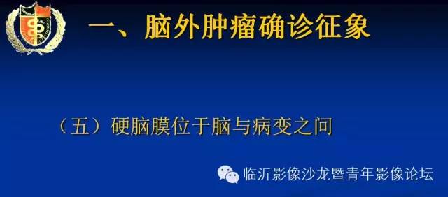 【PPT】颅内肿瘤的影像学定位诊断