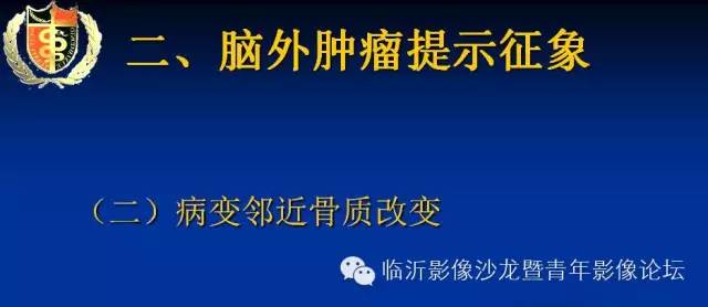 【PPT】颅内肿瘤的影像学定位诊断