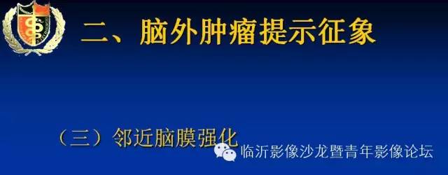 【PPT】颅内肿瘤的影像学定位诊断